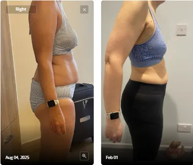 Client before and after progress photos